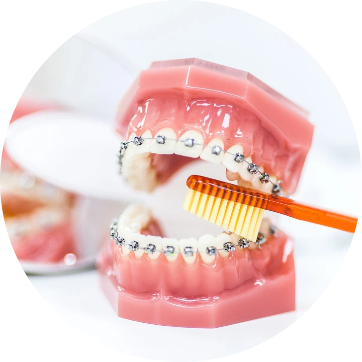 entretien-appareil-dentaire-docteur-israel-orthodontie-nice