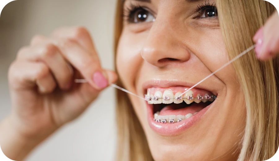 hygiene bucco dentaire docteur israel e Entretenir son appareil orthodontique Orthodontiste Nice, Docteur Nathan Israel