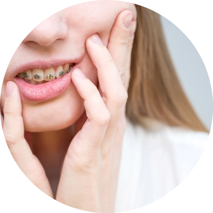 incidents-orthodontie-cabinet-mon-premier-sourire-nice