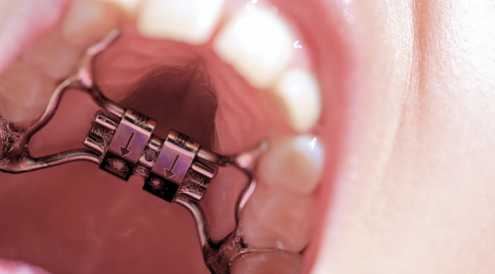 orthodontiste nice 67000 docteur israel